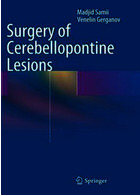 Surgery of Cerebellopontine Lesions2013 جراحی ضایعات